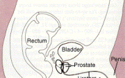 Ztráta erekce po operaci prostaty
