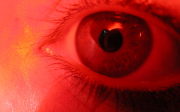 Způsobují vysoké dávky vápníku suché oko?
