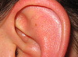 Co na bolest uší